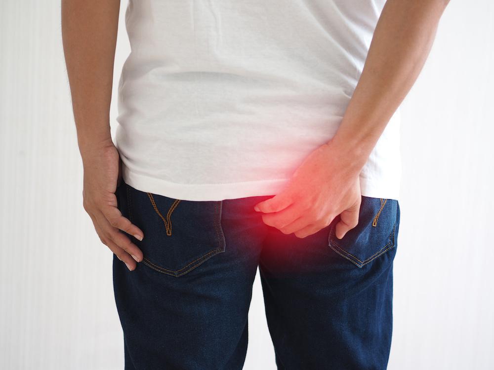 Hemorrhoids