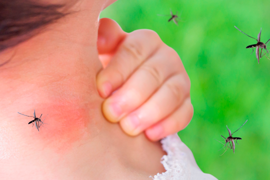 Insect Bites and Itch