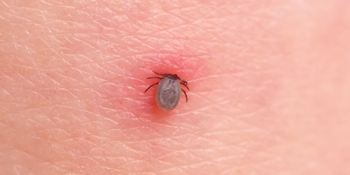 Tick Bites (Prevention of Lyme Disease)